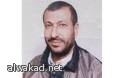 رجل يختار بتر يده المصابة للحصول على يد آلية
