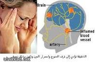 اتفاقية بين جامعة ام القرى وهيئة الاتصالات لقيسا مستوى الإشعاعات في مكة