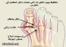 عاشو تسجيل 20 هدفا في بن اليوم الأول من كأس العالم للسيدات