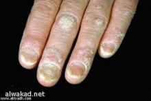 مجلس الوزراء الكويتي يقر قانون. الاعلام الموحد بسجن 10 سنوات لمن ينتقد الامير او ولي العهد