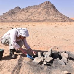 بدء عملية فصل التوأم السيامي التنزاني “حسن وحسين”