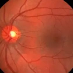 قرص دواء واحد” يحاكي فوائد اللياقة البدنية دون ممارسة الرياضة.. قرص دواء واحد” يحاكي فوائد اللياقة البدنية دون ممارسة الرياضة..