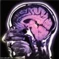 علماء يقرأون ما يدور في الذهن من خلال المسح الإشعاعي
