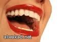 خزن الاسنان لاستخراج خلايا جذعية للمعالجة