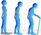 توسيع مواعيد اجراء الاشعة للنساء كبيرات  السن