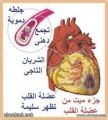 ما الذي يجب أن تعرفه عن  الأزمة القلبية لإنقاذ حياتك؟
