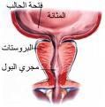 سرطان الشرج يقتل 680 أمريكيا سنوياً